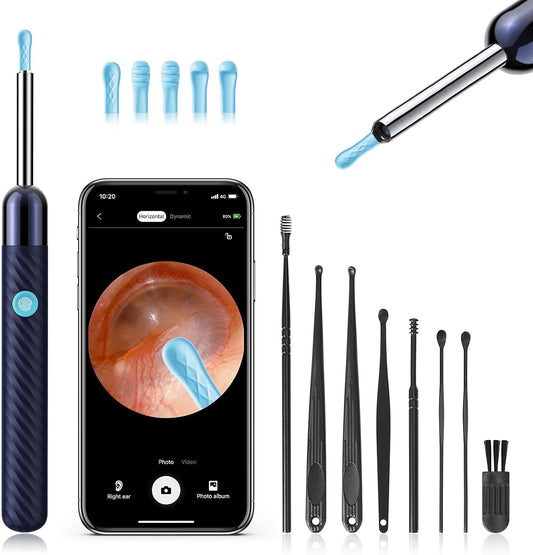 HOM Ear Wax Removal Kit, Safe LED Light Ear Cleaner Tool with 6 Tips & Camera, Reusable for Adults & Kids, Gentle Earwax Remover