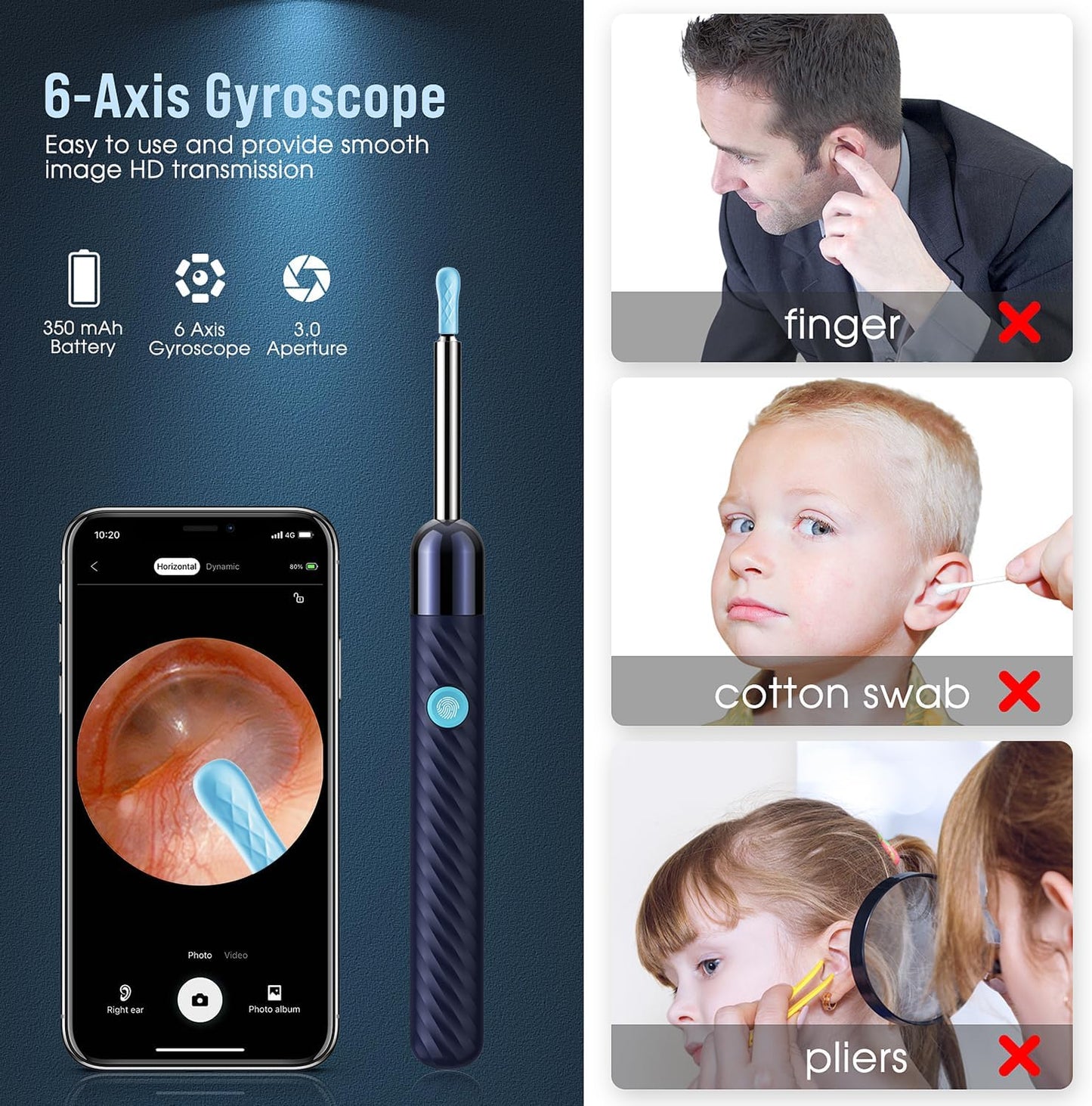 HOM Ear Wax Removal Kit, Safe LED Light Ear Cleaner Tool with 6 Tips & Camera, Reusable for Adults & Kids, Gentle Earwax Remover