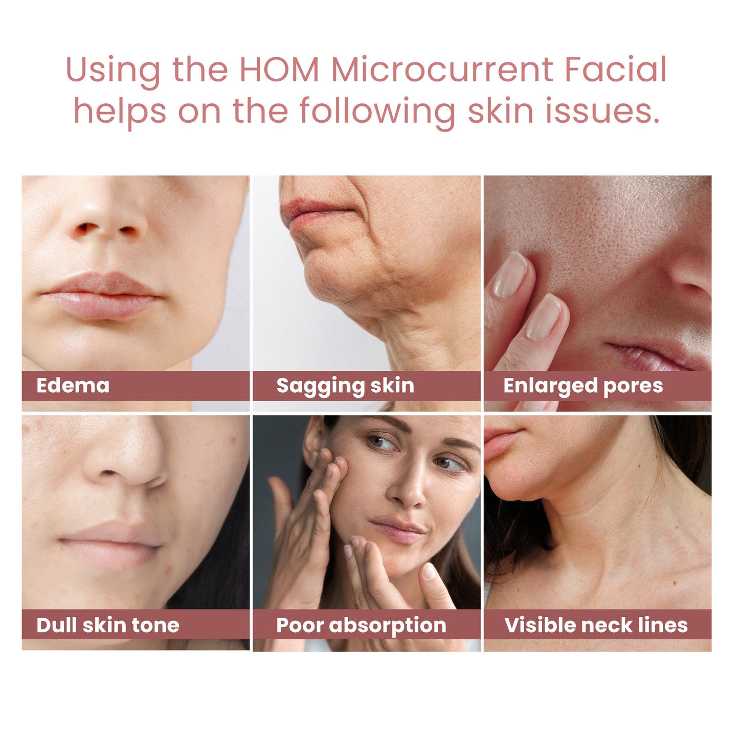 HOM Microcurrent Facial Device - Rechargeable Microsculpt Device for Face and Neck - For Skin Tightening, Face Sculpting & Wrinkle Removal