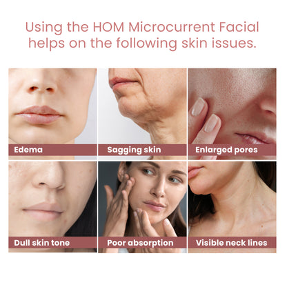 HOM Microcurrent Facial Device - Rechargeable Microsculpt Device for Face and Neck - For Skin Tightening, Face Sculpting & Wrinkle Removal