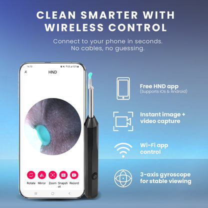 HOM Wireless Ear Wax Removal Kit - Complete Ear Cleaning Kit with HD Camera, 360-Degree View & 4 Interchangeable Silicone Tips - Rechargeable Ear Wax Removal Tool with App Connectivity